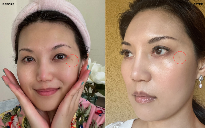 how to fade dark spots