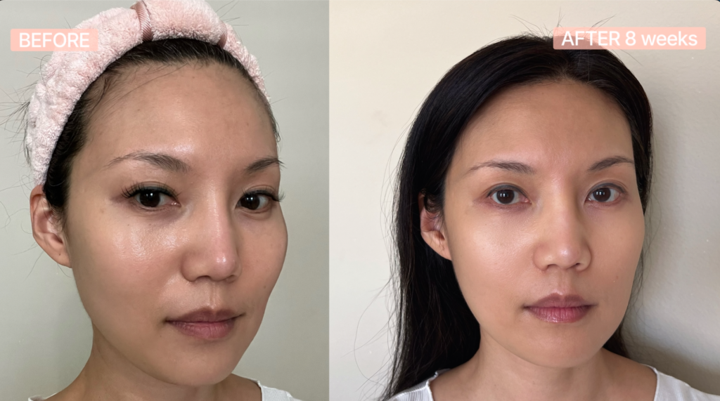 Project E Beauty LED Mask Reviews: I Used It for 10 Weeks—Here's What Actually Happened does red light therapy work before and after